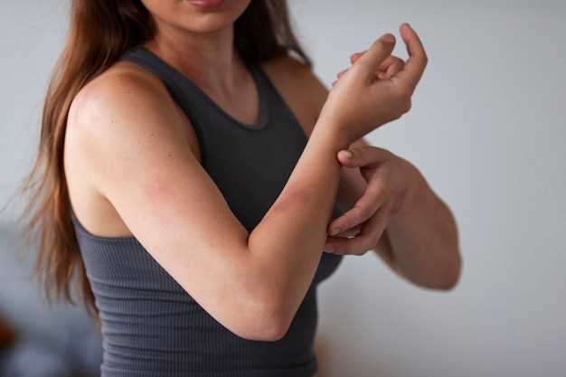 Itching while taking fluoxetine