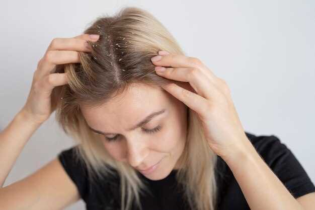 Side effects of fluoxetine hair loss